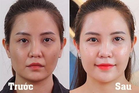 Xông hơi tại massage Vĩnh Yên